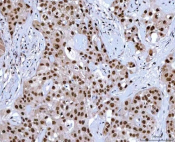 NSUN2 Antibody / SAKI / TRM4