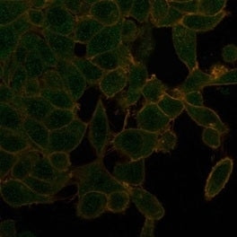 IHC staining of FFPE human thyroid tissue with UBR2 antibody (clone PCRP-UBR2-1D12) at 2ug/ml. HIER: