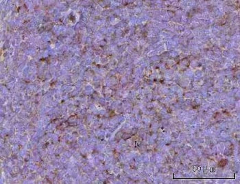 IHC staining of FFPE rat spleen tissue with Cd39 antibody. HIER: boil tissue sections in pH8 EDTA fo