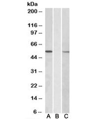 Western blot of HEK293 lysate overexpressing human MGAT1-MYC probed with MGAT1 antibody [1ug/ml] in 