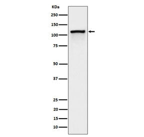 CBL Antibody / Casitas B-lineage lymphoma proto-oncogene&nbsp;(pY774)