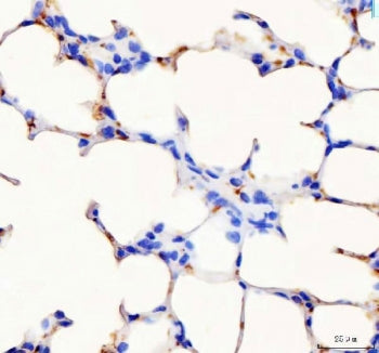 IHC staining of FFPE mouse lung tissue with Pf4 antibody. HIER: boil tissue sections in pH8 EDTA for