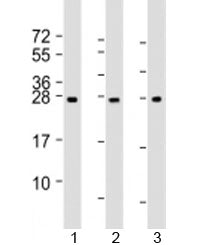 Western blot testing of human 1) human liver, 2) RPMI-8226 and 3) SH-SY5Y lysate with NT5M antibody 