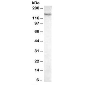 Pyruvate Carboxylase Antibody