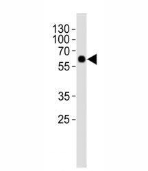 Western blot analysis of lysate from rat lung tissue using SMAD1 antibody at 1:1000. Predicted molec