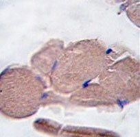 Myostatin Antibody