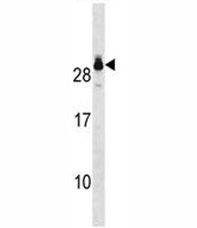 GSTT2 Antibody