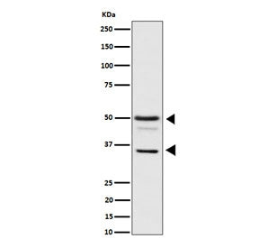 Western blot testing of human HeLa cell lysate with BAG family molecular chaperone regulator 1 antibody. Predicted molecular weight ~50 kDa (long form), 29-33 (short form).