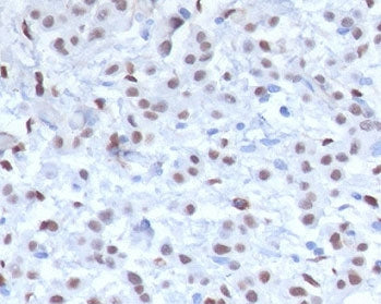 WT1 Antibody / Wilms Tumor 1
