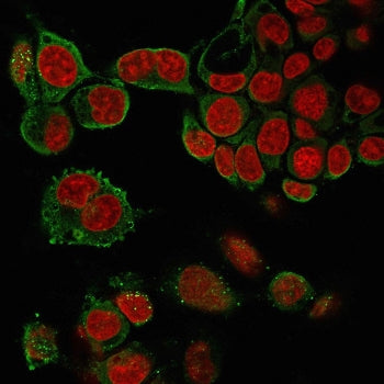 Immunofluorescent staining of PFA-treated human HepG2 cells with TNF alpha antibody (clone 4C6-H8, g