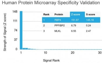 Analysis of HuProt(TM) microarray containing more than 19,000 full-length human proteins using RBP4 