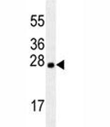 LXN Antibody / Latexin, 0.08ml