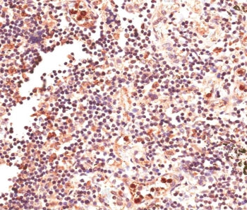 GLI2 Antibody
