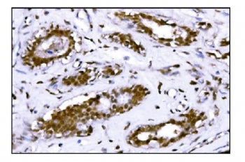 FTO Antibody / Fat mass and obesity associated