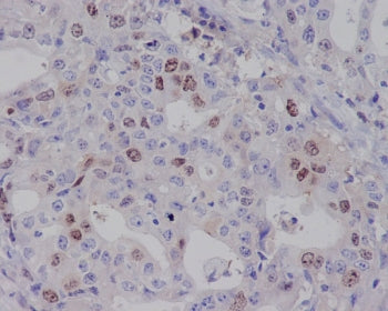 Survivin Antibody / BIRC5