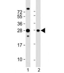 PIMT Antibody / PCMT1