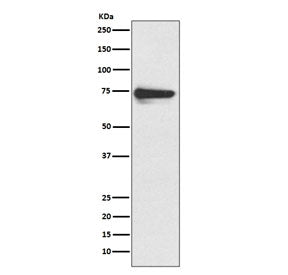 Western blot testing of human melanoma lysate with Tyrosinase antibody. Predicted molecular weight: 
