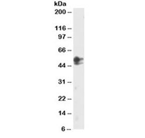Western blot testing of HeLa lysate with SMAD2 antibody at 2ug/ml. The 467 AA and 437 AA isoforms ma