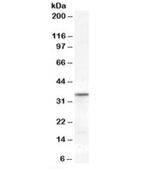 Western blot testing of human heart lysate with VDAC2 antibody at 0.3ug/ml. Predicted molecular weig