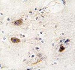 ROR2 Antibody