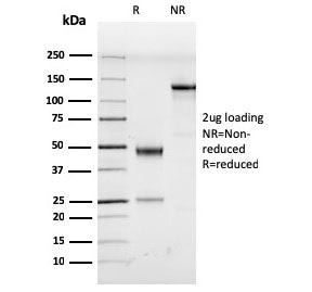 SDS-PAGE analysis of purified, BSA-free HHV8 antibody (clone LN53) as confirmation of integrity and 