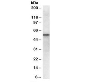 VPS45 Antibody