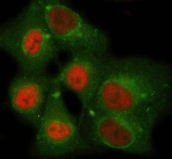 NEMF Antibody / SDCCAG1