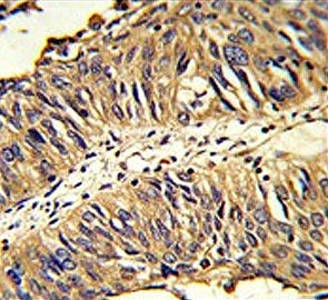 ERp57 Antibody / PDIA3