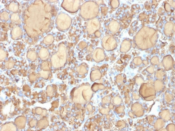 TG Antibody / Thyroglobulin