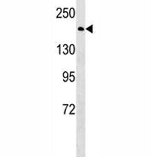 BRCA1 antibody western blot analysis in HeLa lysate. Predicted molecular weight ~207 kDa, commonly o