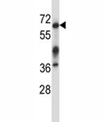 Irak3 Antibody