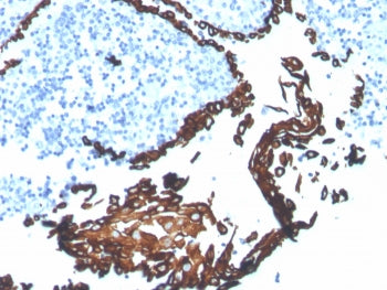 Cytokeratin 5 Antibody / KRT5