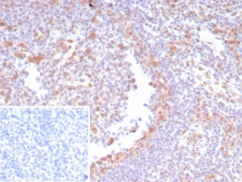 CDK4 Antibody