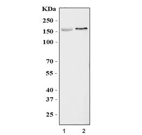 Western blot testing of 1) rat brain and 2) mouse brain tissue lysate with KCNH2 antibody. Expected 