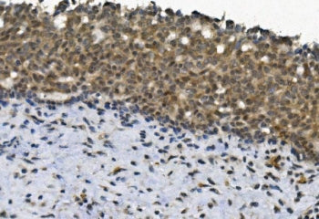 EYA4 Antibody