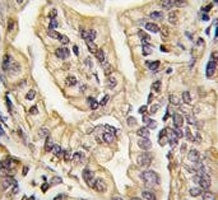 Macrophage Colony Stimulating Factor 1 Receptor Antibody (CSF1R)