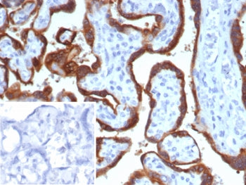 IHC staining of FFPE human placental tissue with HCG-alpha antibody (clone hCGa/7875). Inset: PBS us
