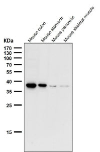 All lanes use the CXCR6 antibody at 1:1000 dilution for 1 hour at room temperature. Predicted molecular weight ~39 kDa.