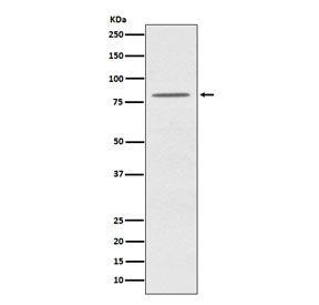 Western blot testing of human HeLa cell lysate with OPA1 antibody. Predicted molecular weight: 111-1