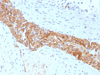 NCAM / CD56 Antibody