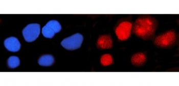 Immunofluorescent staining of FFPE human U-251 cells with IFI16 antibody (red) and DAPI nuclear stai