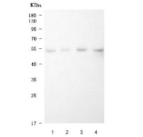 Western blot testing of human 1) prostatic carcinoma tissue (PCT) lysate, 2) cervical carcinoma tiss