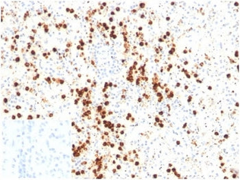 IHC staining of FFPE human spleen tissue with LYZ antibody (clone LYZ/3947). Negative control inset: