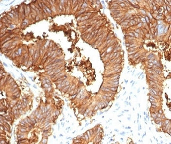 IHC staining of FFPE human colon tissue with recombinant EpCAM antibody (clone EGP40/7035R). HIER: b