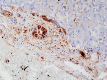 Recombinant GST pi Antibody / GSTP1