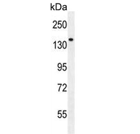 Phospholipase C-L2 Antibody / PLCL2