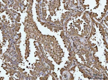 SOCS1 Antibody / TIP3 / SSI1