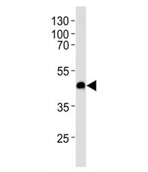 Western blot analysis of lysate from U-251 MG cell line using CXCR7 antibody at 1:1000 for each lane