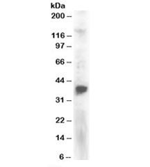 PINX Antibody