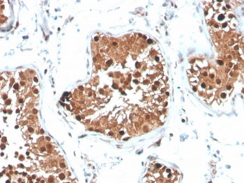 IHC staining of FFPE human testis with Inhibin alpha antibody. HIER: boil tissue sections in pH 9 10